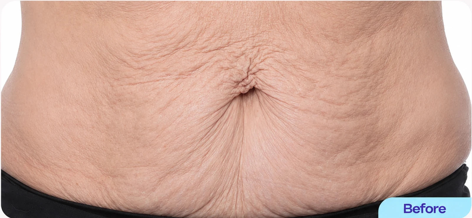 Illustrative before belly skincare
